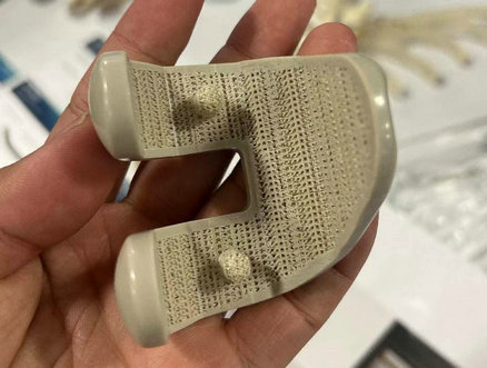 Implantes PEEK de Grau Médico Impressos em 3D