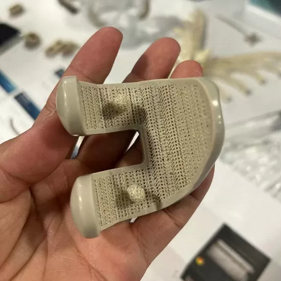 Implantes PEEK de Grau Médico Impressos em 3D