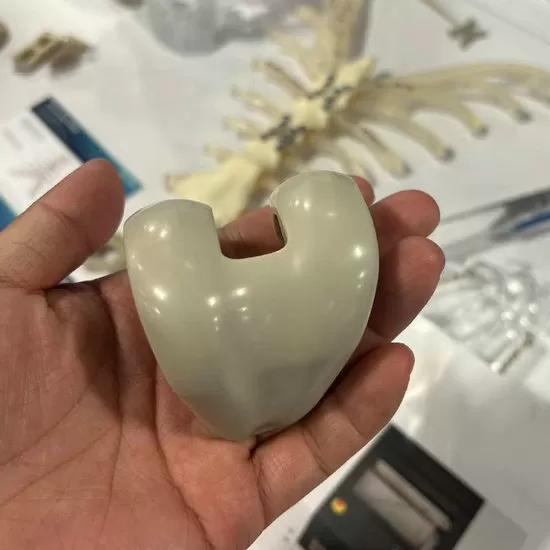 Implantes PEEK de Grau Médico Impressos em 3D