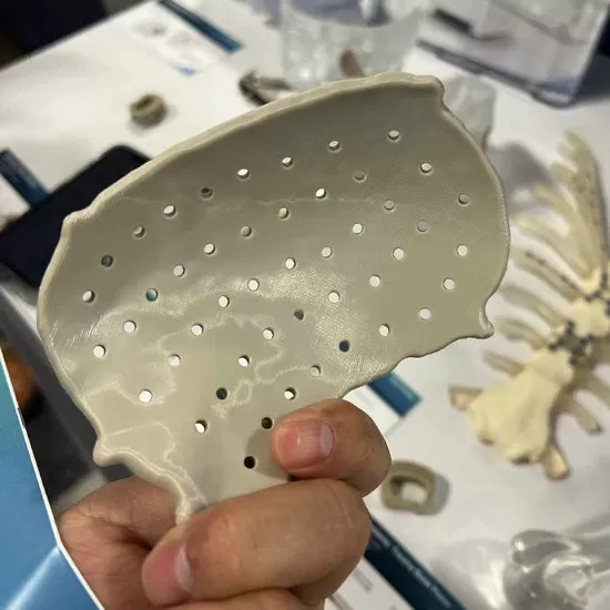 Implantes PEEK de Grau Médico Impressos em 3D