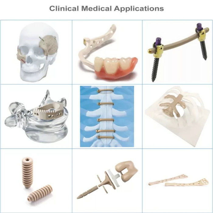 PEEK Médico vs. PEEK Industrial: Principais Diferenças