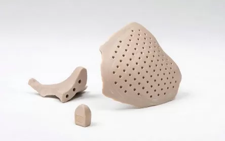 Hospital de Basileia imprime em 3D o primeiro implante maxilofacial de PEEK no local